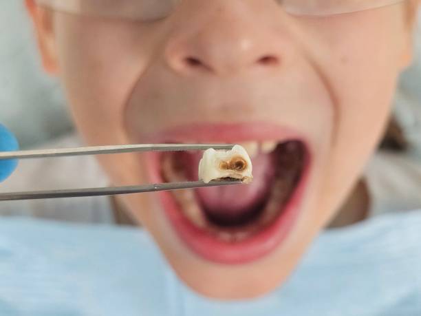 Best Emergency Treatment for Toothache in Newcastle, WY